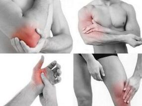 bolesť kĺbov rúk a nôh